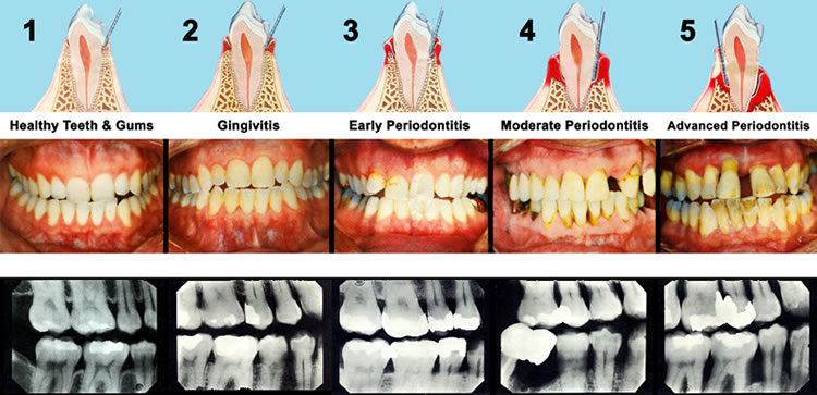 Periodontal_Images.jpg