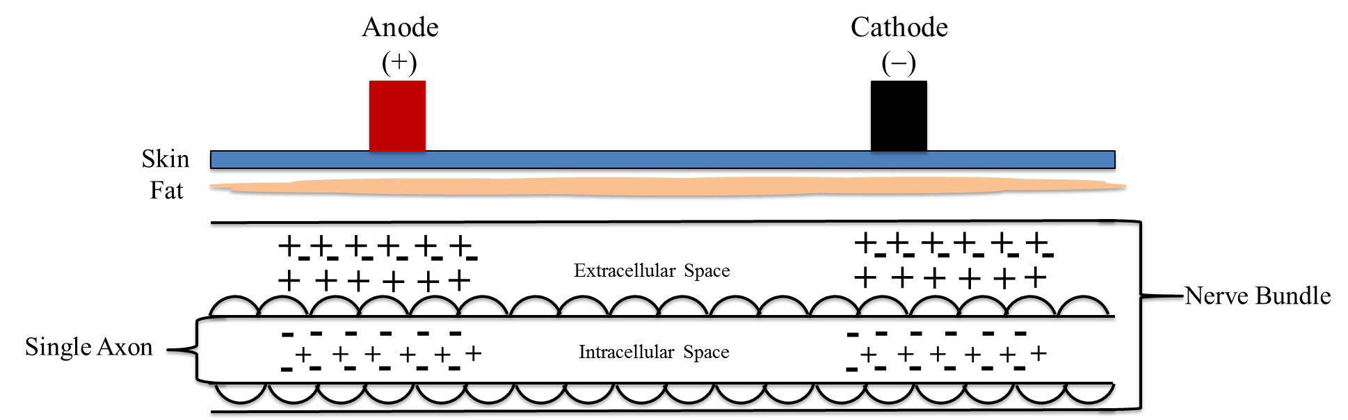 Example of transdermal electric muscle stimulation by means of a