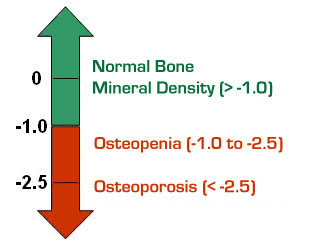 Osteoporosis-Graph.jpg
